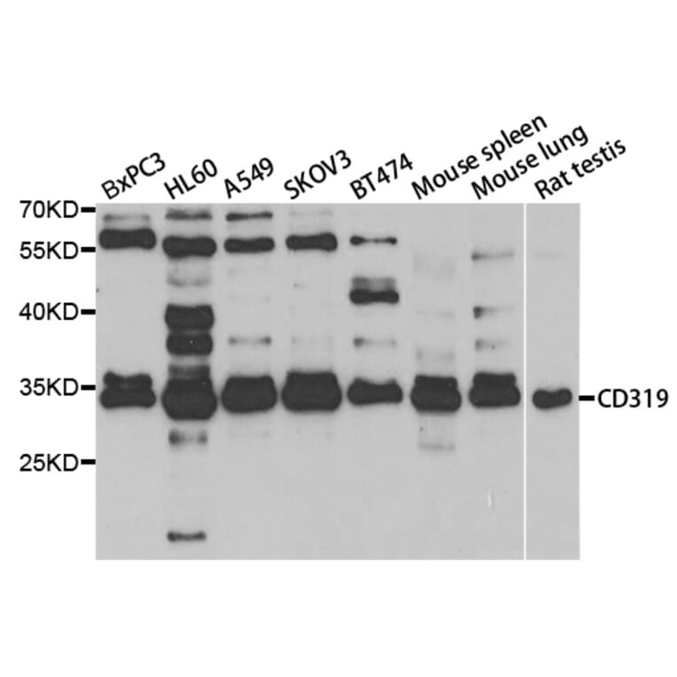 Anti-CD319 Antibody from Bioworld Technology (BS7859) - Antibodies.com