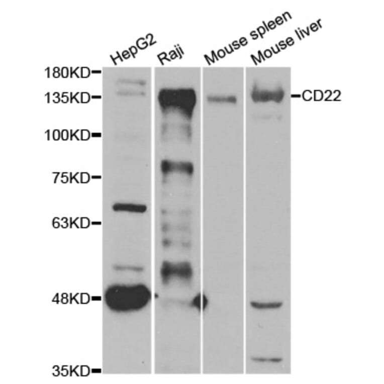 Anti-CD22 Antibody from Bioworld Technology (BS7860) - Antibodies.com