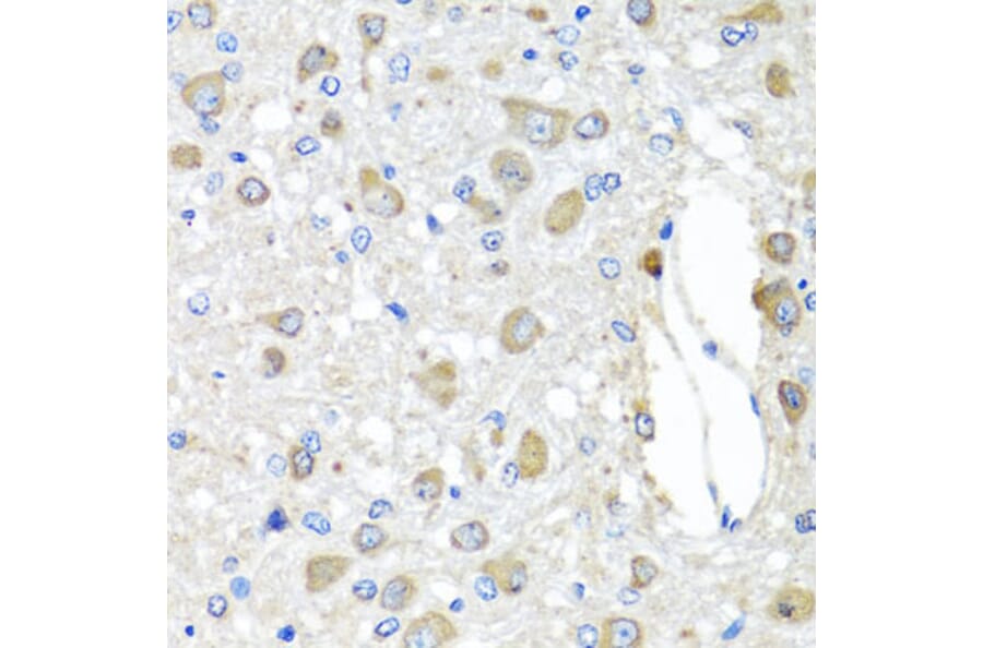 Anti-BAG5 Antibody from Bioworld Technology (BS7862) - Antibodies.com