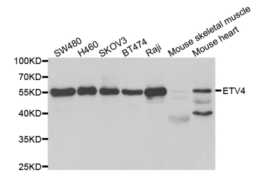 Anti-ETV4 Antibody from Bioworld Technology (BS7864) - Antibodies.com