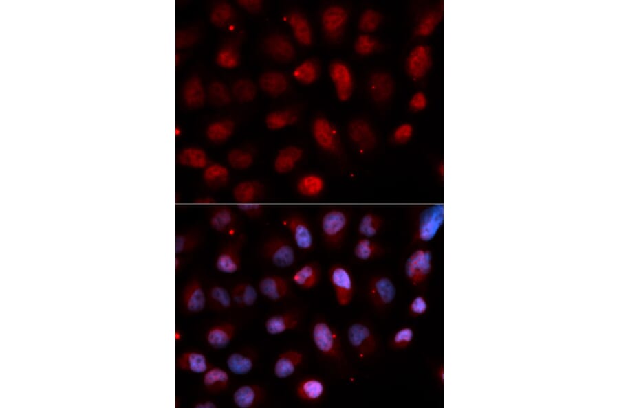 Anti-ETV4 Antibody from Bioworld Technology (BS7864) - Antibodies.com