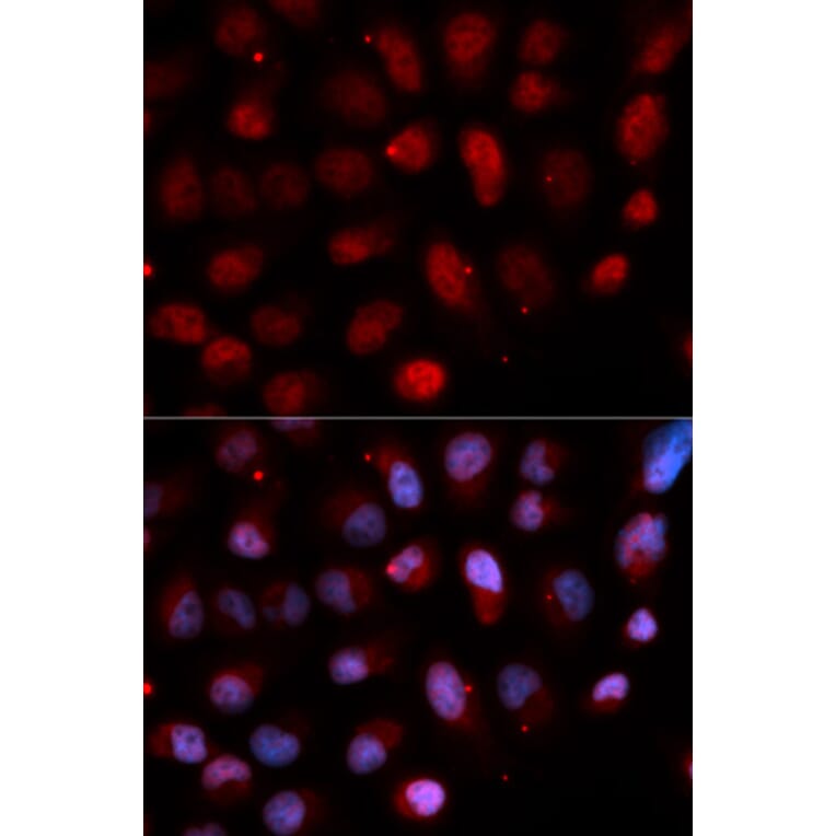 Anti-ETV4 Antibody from Bioworld Technology (BS7864) - Antibodies.com