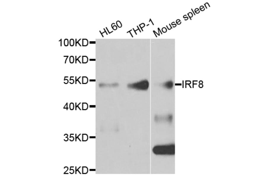Anti-IRF8 Antibody from Bioworld Technology (BS7865) - Antibodies.com