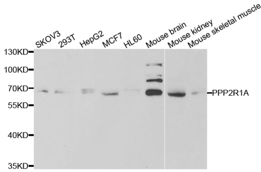 Anti-PPP2R1A Antibody from Bioworld Technology (BS7866) - Antibodies.com