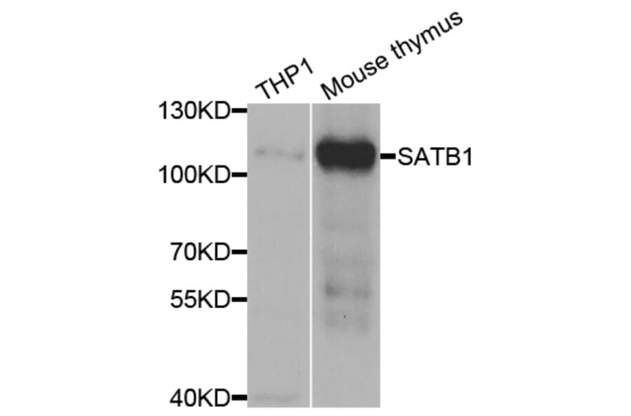 Anti-SATB1 Antibody from Bioworld Technology (BS7867) - Antibodies.com