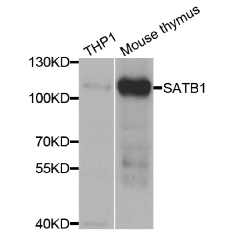 Anti-SATB1 Antibody from Bioworld Technology (BS7867) - Antibodies.com