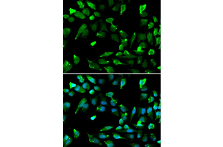 Anti-SATB1 Antibody from Bioworld Technology (BS7867) - Antibodies.com