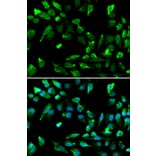 Anti-SATB1 Antibody from Bioworld Technology (BS7867) - Antibodies.com