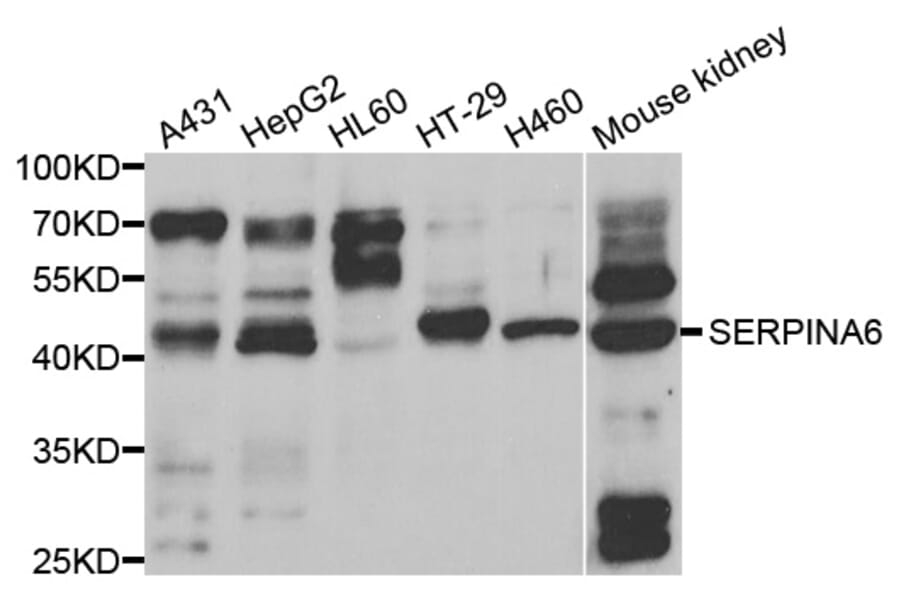 Anti-SERPINA6 Antibody from Bioworld Technology (BS7868) - Antibodies.com