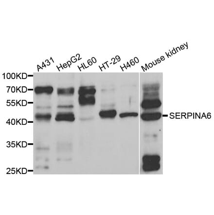 Anti-SERPINA6 Antibody from Bioworld Technology (BS7868) - Antibodies.com
