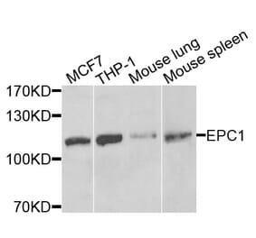 Anti-EPC1 Antibody from Bioworld Technology (BS7870) - Antibodies.com