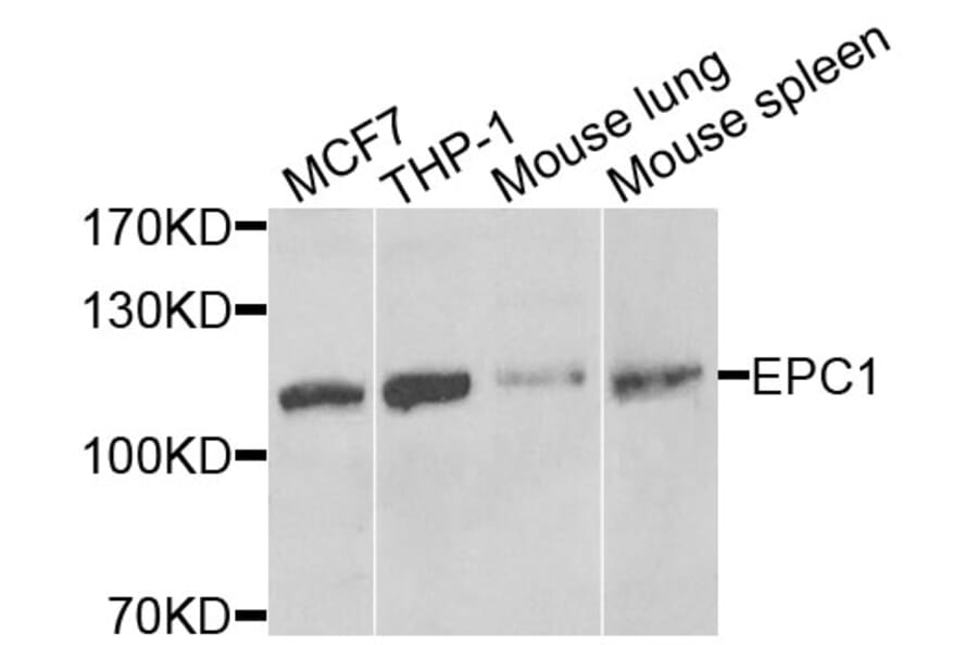 Anti-EPC1 Antibody from Bioworld Technology (BS7870) - Antibodies.com