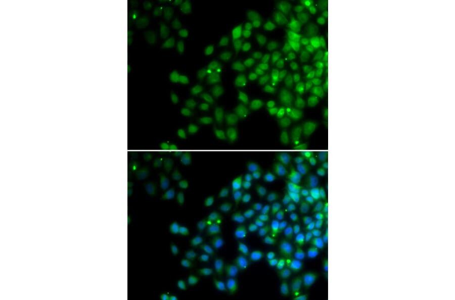 Anti-EPC1 Antibody from Bioworld Technology (BS7870) - Antibodies.com