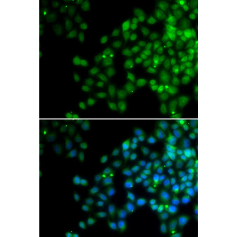 Anti-EPC1 Antibody from Bioworld Technology (BS7870) - Antibodies.com