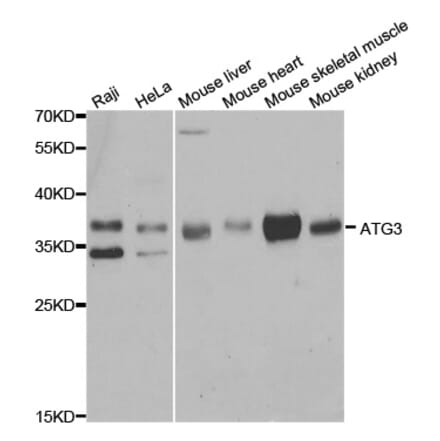 Anti-ATG3 Antibody from Bioworld Technology (BS7872) - Antibodies.com