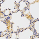 Anti-ATG3 Antibody from Bioworld Technology (BS7872) - Antibodies.com