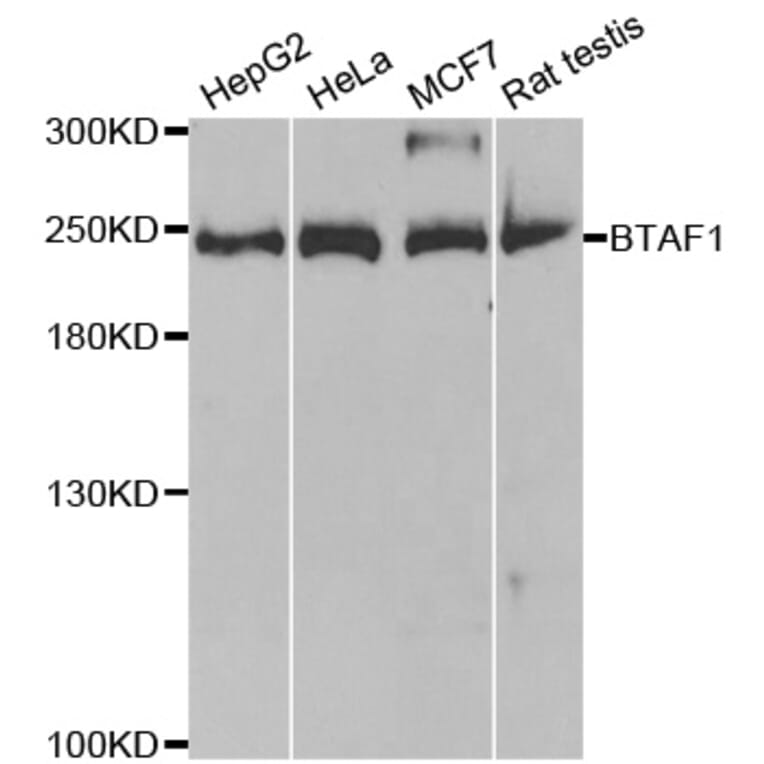 Anti-BTAF1 Antibody from Bioworld Technology (BS7874) - Antibodies.com