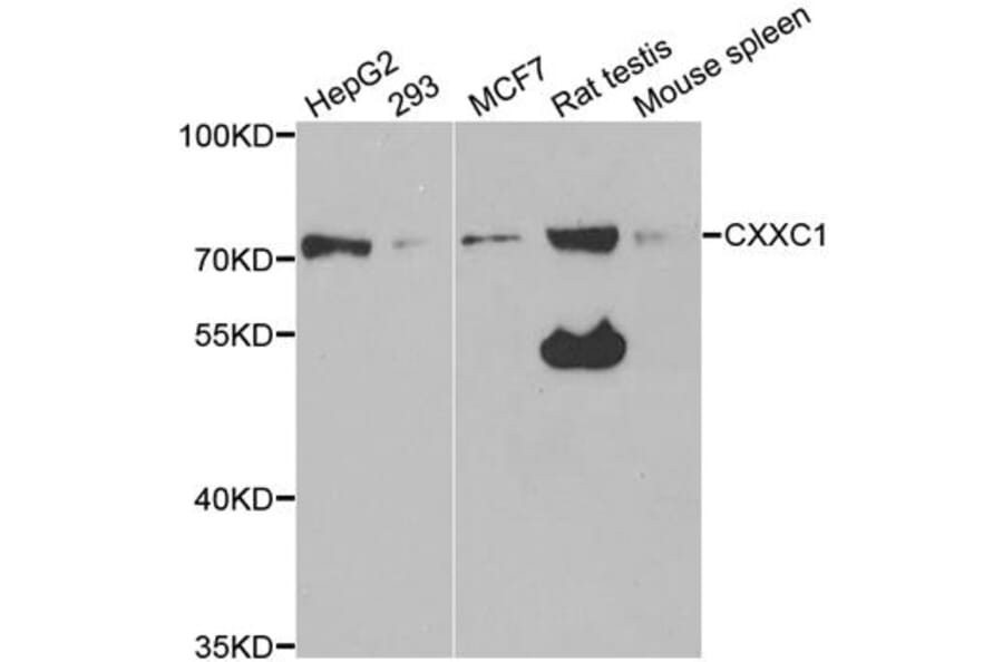 Anti-CXXC1 Antibody from Bioworld Technology (BS7877) - Antibodies.com