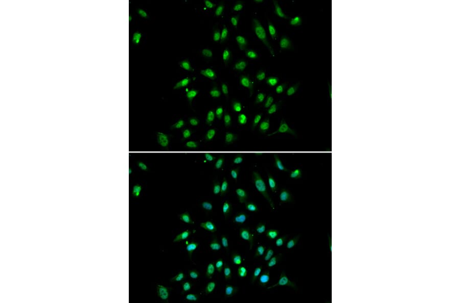 Anti-CXXC1 Antibody from Bioworld Technology (BS7877) - Antibodies.com