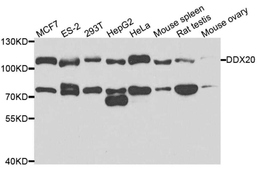 Anti-DDX20 Antibody from Bioworld Technology (BS7879) - Antibodies.com