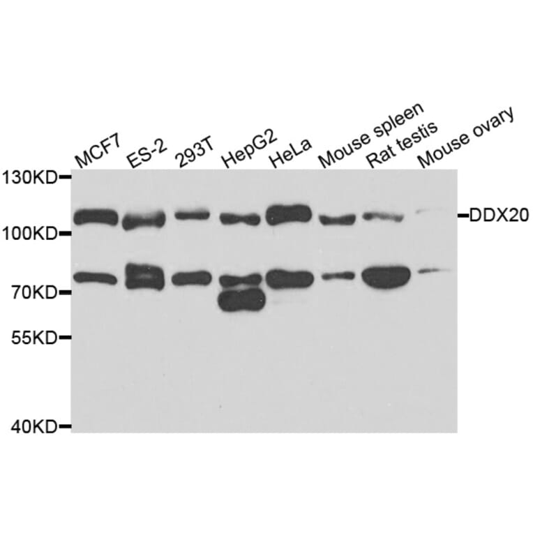 Anti-DDX20 Antibody from Bioworld Technology (BS7879) - Antibodies.com