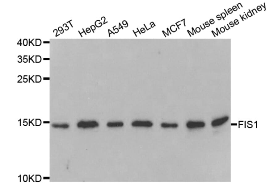 Anti-FIS1 Antibody from Bioworld Technology (BS7881) - Antibodies.com