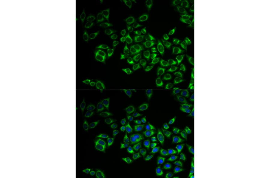 Anti-FIS1 Antibody from Bioworld Technology (BS7881) - Antibodies.com
