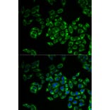 Anti-FIS1 Antibody from Bioworld Technology (BS7881) - Antibodies.com