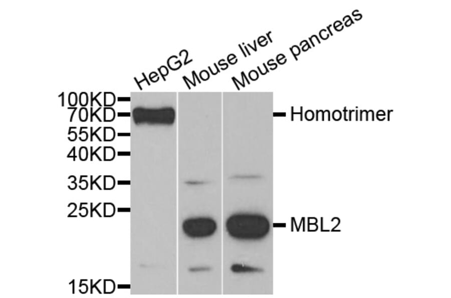 Anti-MBL2 Antibody from Bioworld Technology (BS7883) - Antibodies.com