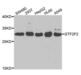 Anti-GTF2F2 Antibody from Bioworld Technology (BS7884) - Antibodies.com