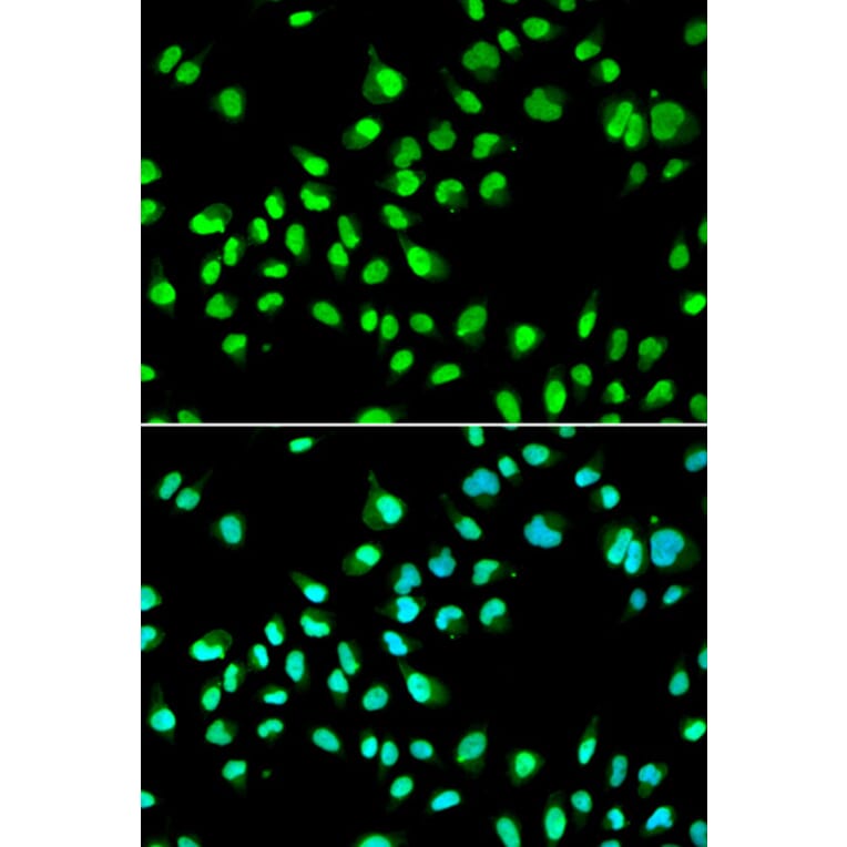 Anti-GTF2F2 Antibody from Bioworld Technology (BS7884) - Antibodies.com