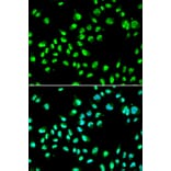 Anti-GTF2F2 Antibody from Bioworld Technology (BS7884) - Antibodies.com