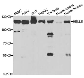 Anti-HELLS Antibody from Bioworld Technology (BS7887) - Antibodies.com