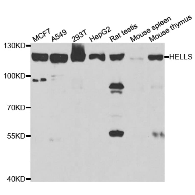 Anti-HELLS Antibody from Bioworld Technology (BS7887) - Antibodies.com