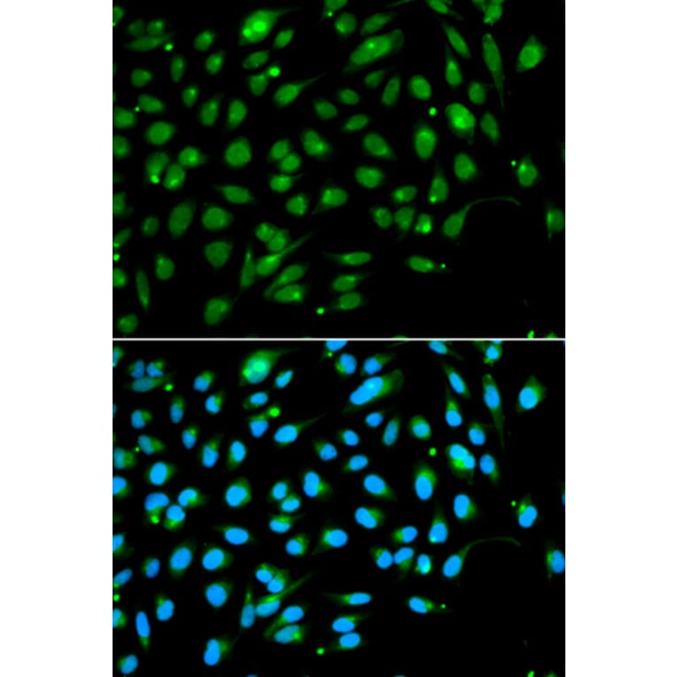 Anti-ING3 Antibody from Bioworld Technology (BS7888) - Antibodies.com