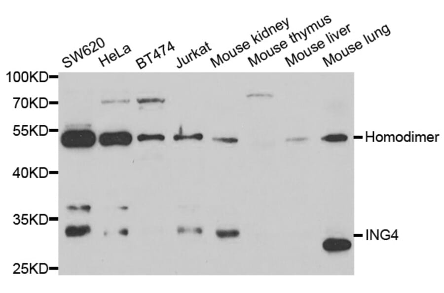 Anti-ING4 Antibody from Bioworld Technology (BS7889) - Antibodies.com