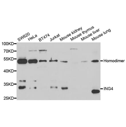 Anti-ING4 Antibody from Bioworld Technology (BS7889) - Antibodies.com