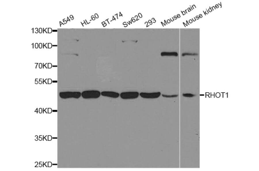 Anti-RHOT1 Antibody from Bioworld Technology (BS7892) - Antibodies.com