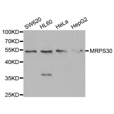 Anti-MRPS30 Antibody from Bioworld Technology (BS7894) - Antibodies.com