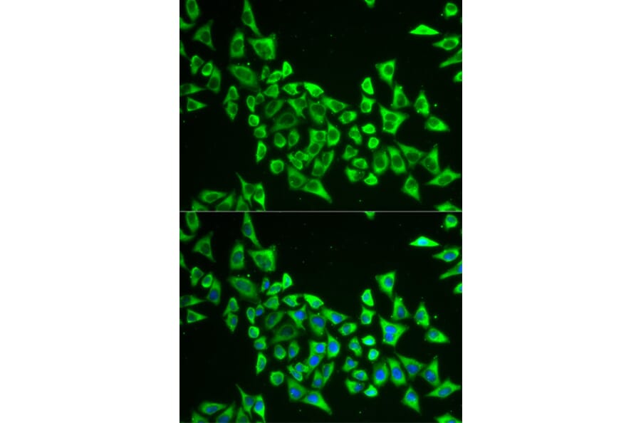 Anti-MRPS30 Antibody from Bioworld Technology (BS7894) - Antibodies.com