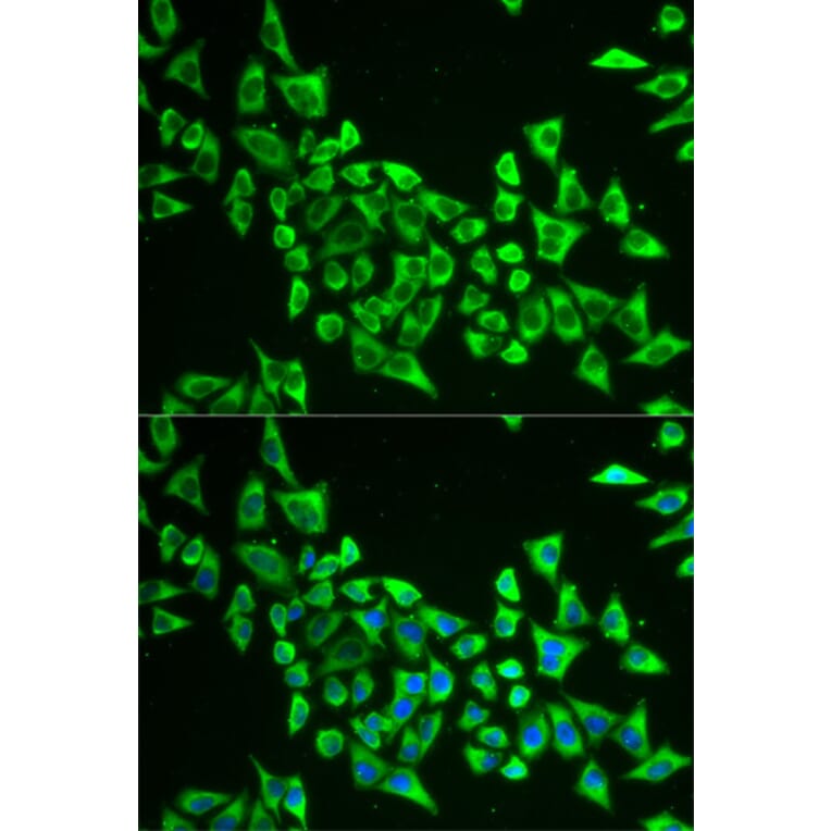 Anti-MRPS30 Antibody from Bioworld Technology (BS7894) - Antibodies.com