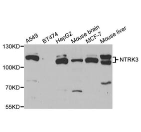 Anti-NTRK3 Antibody from Bioworld Technology (BS7895) - Antibodies.com