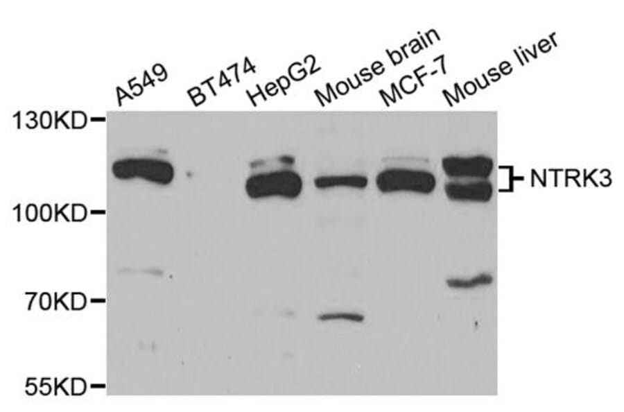 Anti-NTRK3 Antibody from Bioworld Technology (BS7895) - Antibodies.com