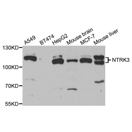 Anti-NTRK3 Antibody from Bioworld Technology (BS7895) - Antibodies.com