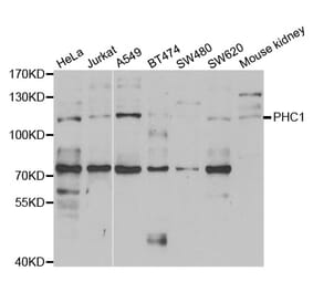 Anti-PHC1 Antibody from Bioworld Technology (BS7896) - Antibodies.com