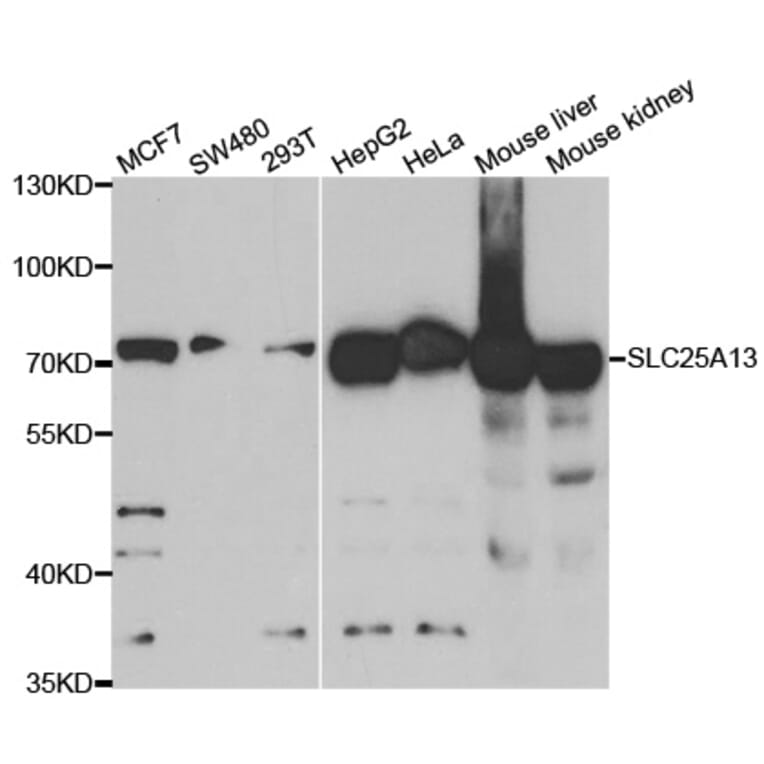 Anti-SLC25A13 Antibody from Bioworld Technology (BS7897) - Antibodies.com