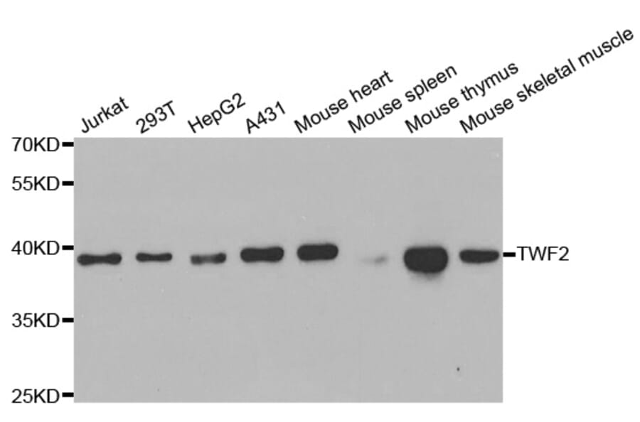 Anti-TWF2 Antibody from Bioworld Technology (BS7906) - Antibodies.com