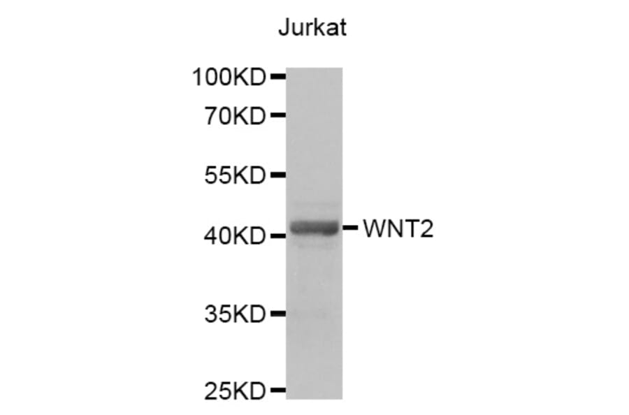 Anti-WNT2 Antibody from Bioworld Technology (BS7909) - Antibodies.com
