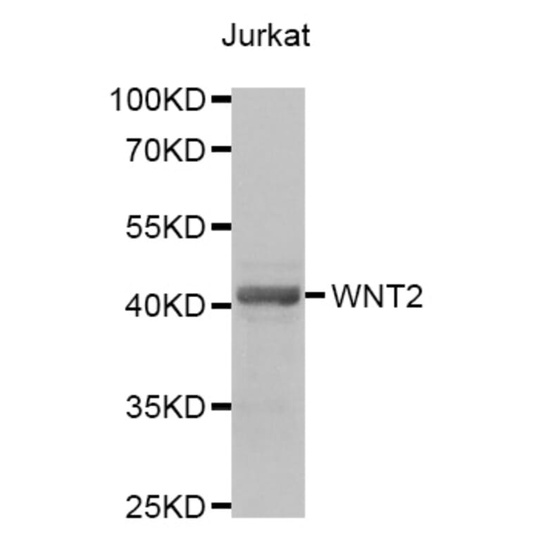 Anti-WNT2 Antibody from Bioworld Technology (BS7909) - Antibodies.com