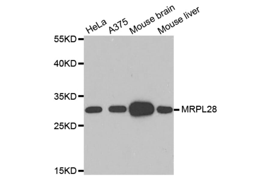 Anti-MRPL28 Antibody from Bioworld Technology (BS7911) - Antibodies.com
